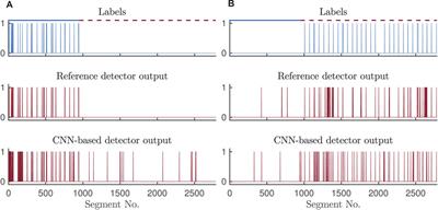 Training Convolutional Neural Networks on Simulated Photoplethysmography Data: Application to Bradycardia and Tachycardia Detection